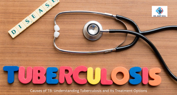 Causes of TB: Understanding Tuberculosis and Its Treatment Options