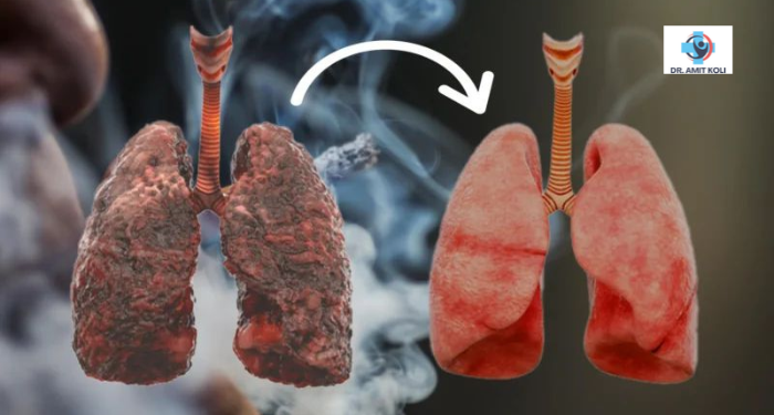 How Smoking and Alcohol Consumption Damage Your Lungs: Causes, Risks, and Prevention